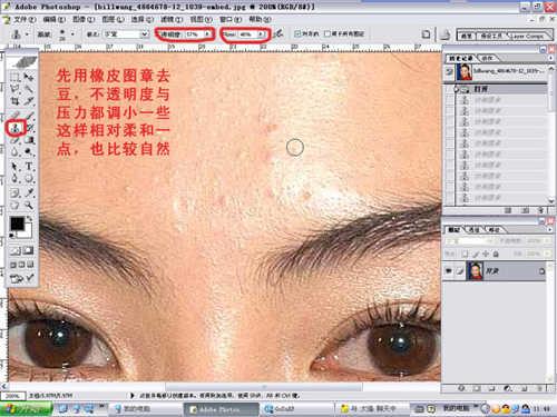 Photoshop脸部祛痘处理教程(1)