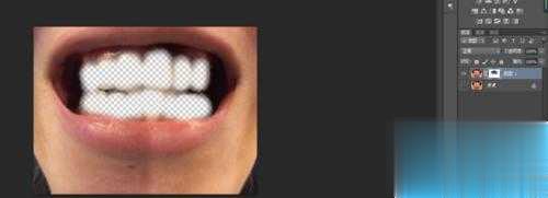 PS给牙齿进行美白处理教程(5)