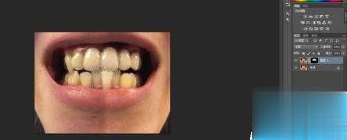 PS给牙齿进行美白处理教程(8)