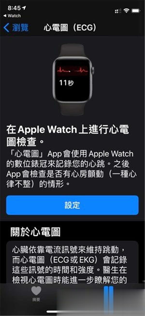 Apple Watch 才在台湾开放 ECG 心电图功能，就有医师分享帮病患找出心脏问题的实例