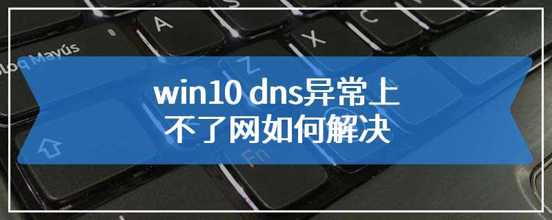 win10 dns异常上不了网如何解决