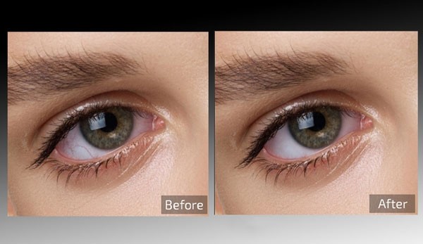 Retouch4me Eye Vessels(图片处理工具)