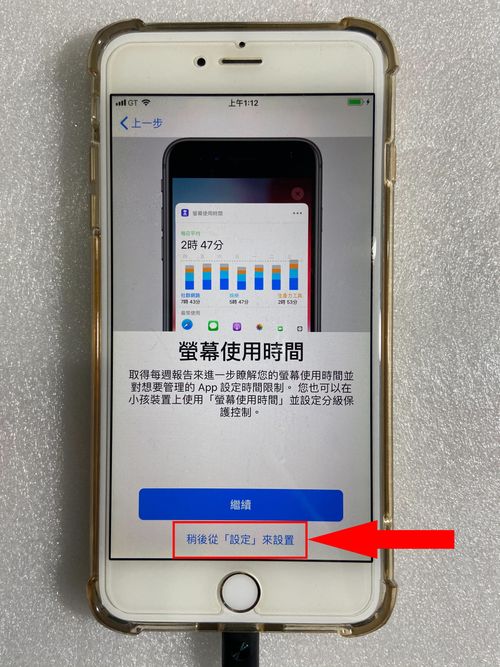 稍后从「设定」来设置